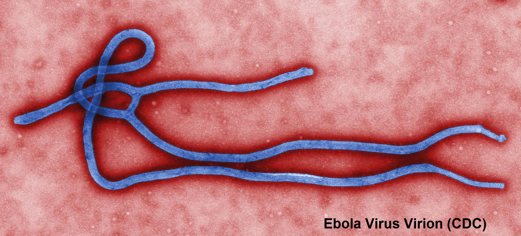 ebola virus and the cytokine storm